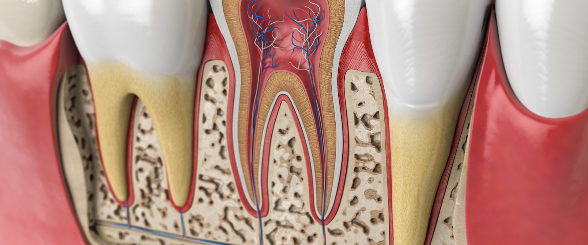 Can Dentists Pull Teeth That Are Infected?