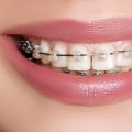 Why Orthodontists and Not Orthodontics?