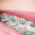 Which Dentist Can Provide Orthodontic Care?