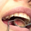 Do orthodontists check for cavities?