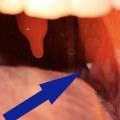 Do dentists deal with tonsils?