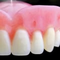 What type of dentist does dentures?