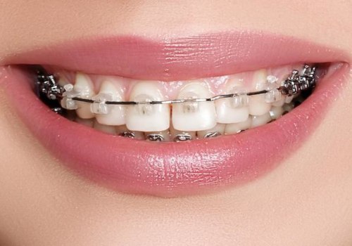 Why Orthodontists and Not Orthodontics?