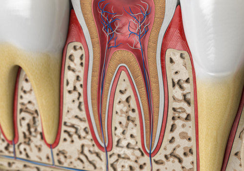 Can Dentists Pull Teeth That Are Infected?