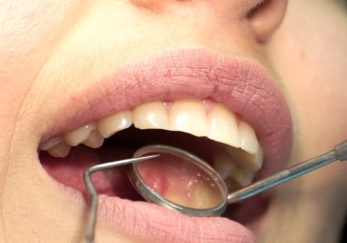Do orthodontists check for cavities?