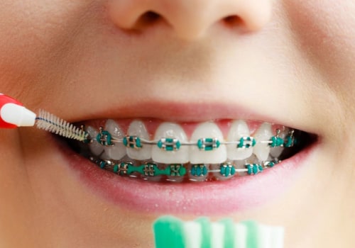 Do orthodontists also clean teeth?