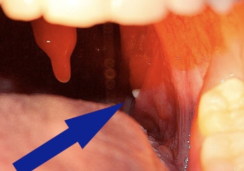 Do dentists deal with tonsils?