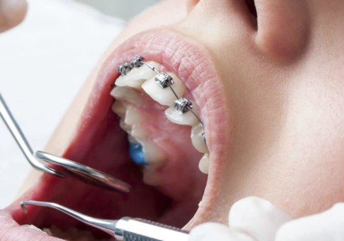 Should i go to dentist or orthodontist first?