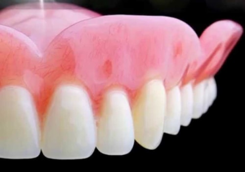 Who Should You See for Dental Prosthesis?