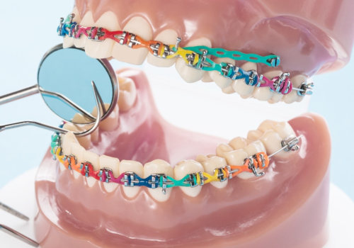 Do orthodontists make more than dentists?